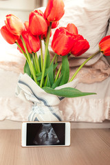 expecting a pregnancy photo of an ultrasound examination on a smartphone