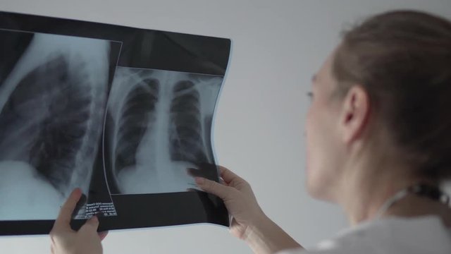 Female doctor examines x-ray of lungs, holding it in hands indoors.