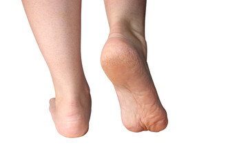 the medicine, aphalangia absence of phalanges of fingers on the  foot, consequence of failure of...