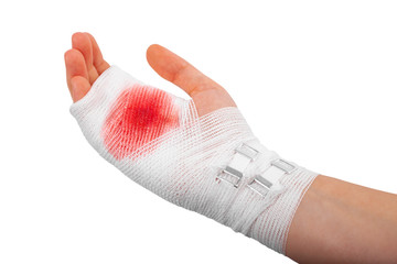 Injured hand of the girl tied up by white bandage