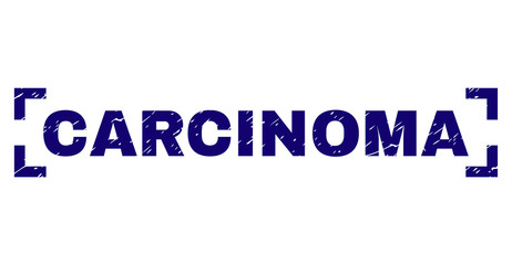 CARCINOMA text seal print with grunge texture. Text caption is placed between corners. Blue vector rubber print of CARCINOMA with unclean texture.