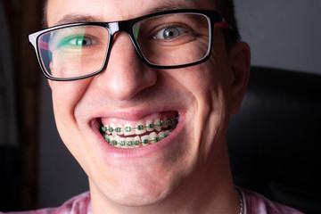 Face of a young man with metal dental braces and glasses close-up