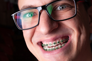 Portrait of a man with crooked teeth and metal brackets close-up. Young man with dental orthodontic...