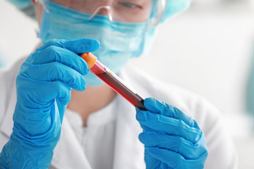 Woman working with blood sample in laboratory, closeup