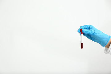 Hand of laboratory assistant holding test tube with blood sample on white background - obrazy, fototapety, plakaty