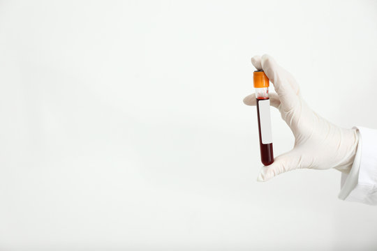 Hand Of Laboratory Assistant Holding Test Tube With Blood Sample On White Background