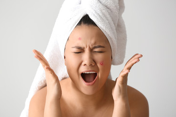 Portrait of stressed Asian woman with acne problem on white background