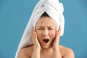 Portrait of stressed Asian woman with acne problem on color background