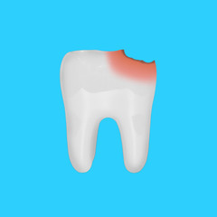 white tooth model with damage from caries, isolated on blue background. Concept of care and dental health. Object for your project or design.