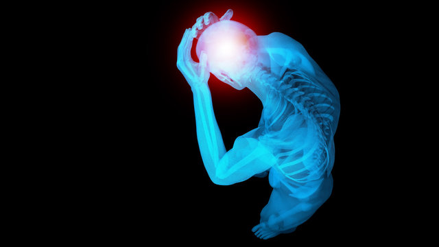 x ray 3d rendered skeletal medical illustration