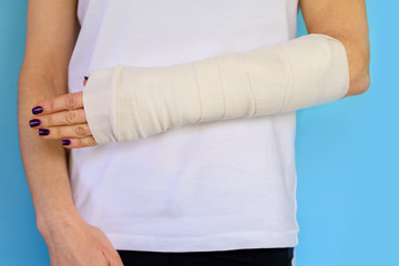 Woman with broken arm bone in cast, plastered hand on blue background.