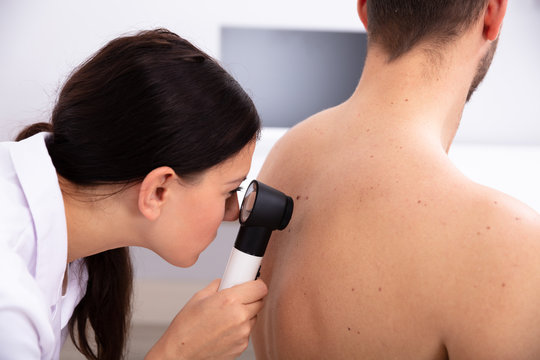 Doctor Examining Pigmented Skin On Man's Back