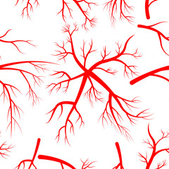 pattern with human arteries.