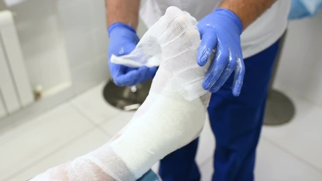 doctor traumatologist puts a plaster or cast on the broken leg of the patient.