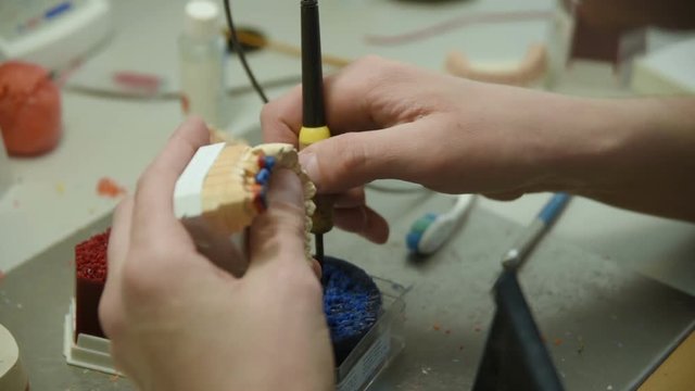 The dentist makes a mold of the teeth. prosthetic dentistry, dental prosthetics