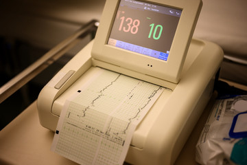 cardiotocography machine of hospital with monitor and chart on paper