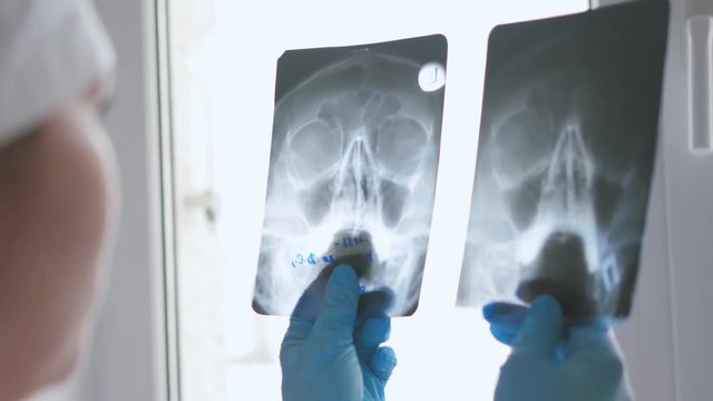 Female doctor examines 2 x-rays against the window.  View from the shoulder.