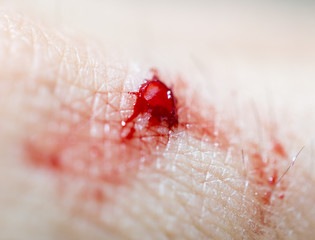 Blood on the skin from a cut with a knife