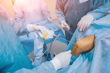 Arthroscope surgery. Orthopedic surgeons in teamwork in the operating room with modern arthroscopic...