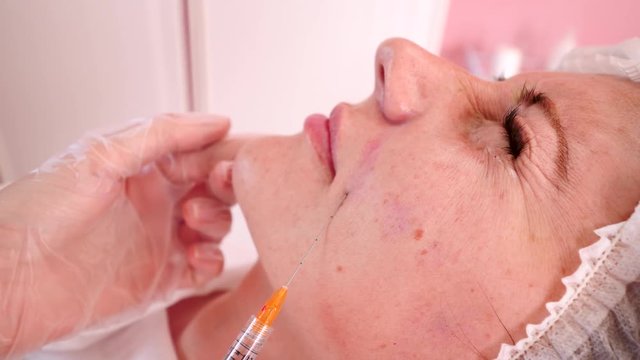 Doctor pulls needle from the patient face after introduction of fillers