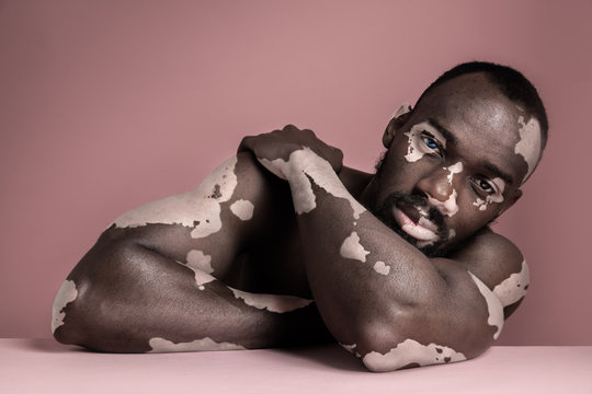 Close up fashion portrait of a male afro or african model with white pigmentation. Concept of no racism. Conceptual image of young man at pink studio background