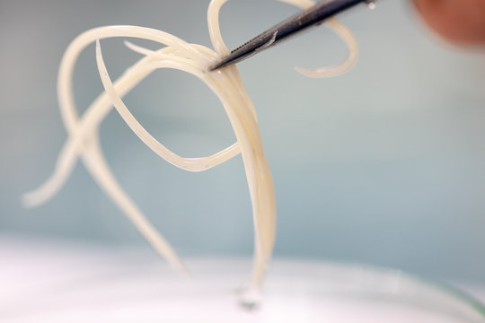 Ascariasis is a disease caused by the parasitic roundworm Ascaris lumbricoides for education in laboratories.