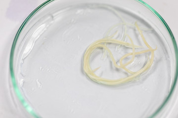 Ascariasis is a disease caused by the parasitic roundworm Ascaris lumbricoides for education in laboratories.