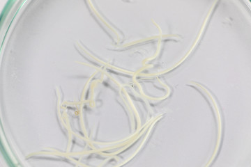 Ascariasis is a disease caused by the parasitic roundworm Ascaris lumbricoides for education in...