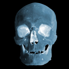 X-ray image of a human skull, imitation. Isolated on black. Smiling skull.
