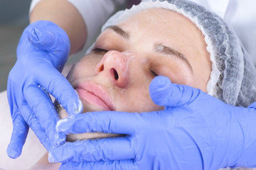 Obraz na płótnie Canvas Cosmetologist wipes the face of a young woman with cotton pads. Hands of the beautician in gloves and a face closeup. Beauty treatments for the face.