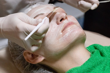 Face peeling mask, spa beauty treatment, skincare. 