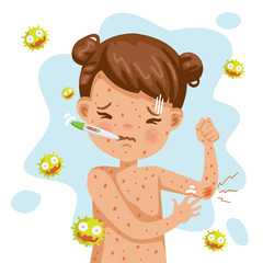 German 
Rash fever of rubella. A sick little girl with fever and red rash. Gel reduces heat. Feeling bad when symptoms. Cartoons of rubella virus. Cause of infection.