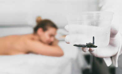 Hirudotherapy procedure. The doctor holds the leech, close-up, before applying it to the patient's...