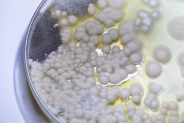 Colony characteristic of Actinomyces, Bacteria, yeast and Mold on selective media from soil samples for study in laboratory microbiology.