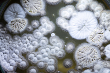 Colony characteristic of Actinomyces, Bacteria, yeast and Mold on selective media from soil samples...