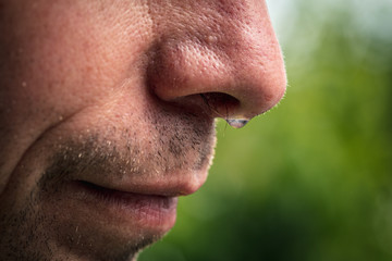 Nose dripping water