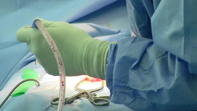 Surgery for the patient using surgical instruments.