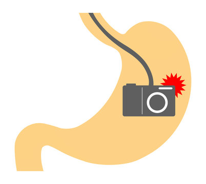 12,976 件の最適な 胃カメラ 画像、ストック写真、ベクター | Adobe Stock