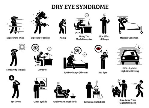 Dry Eye Syndrome. Icons illustrations depict  the symptoms, causes, effects, and home remedies for dry eye health problem.