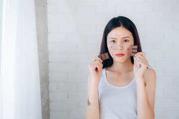 Young Asian Woman Acne Problem Face with Chocolate bar UnHappy Eating,His Stressful face.