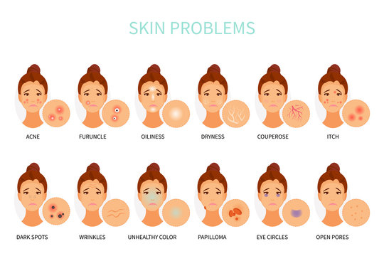 Skin problems vector