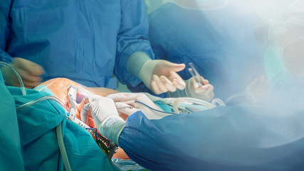 open heart cardiac surgery in hospital cardiovascular microsurgery with minithoracotomy procedure,...