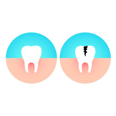 Healthy and damaged tooth. Caries disease flat vector illustration.