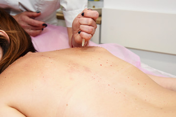Obraz na płótnie Canvas Beauty injections in the salon. The procedure for skin tightening and rejuvenation.