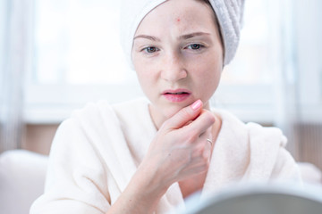 Beautiful unhappy young woman looking at acne on her face. Concept of hygiene and care for the skin
