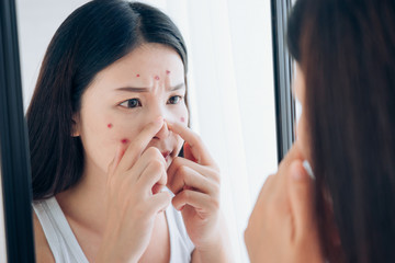 Young Asian woman squeeze acne problem face looking at mirror her without Skincare.