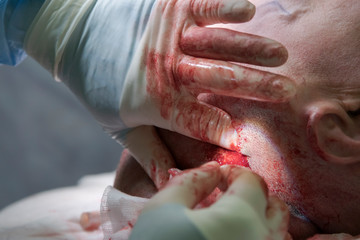 Surgeon Put Finger Inside The Head