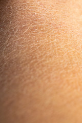 Fototapeta premium Woman's dry skin on leg, Close up & Macro shot, Asian skin tone, Abstract background