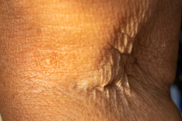 Fototapeta premium Senior woman's wrinkled foldable joint of the arm, Close up & Macro shot, Selective focus, Light & Shadow, Body part, Healthcare concept