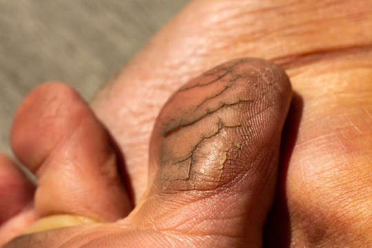 Woman's  toe break skin on wood, Close up & Macro shot, Selective focus, Asian body skin part, Healthcare concept